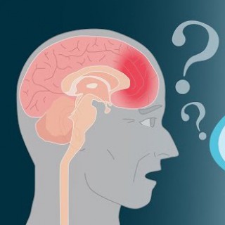 O que é demência frontotemporal? Quais os sintomas e o tratamento?